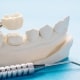 Dental Crown