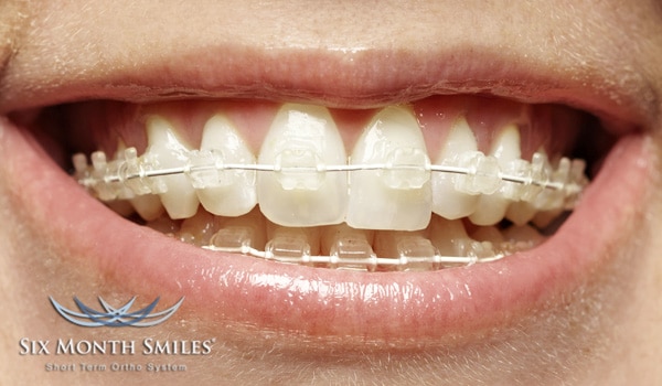 Dental Care in North Little Rock AR