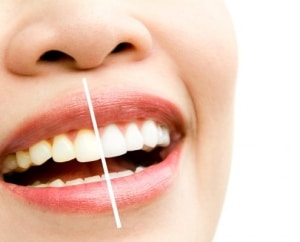 Cosmetic Dentistry in North Little Rock AR