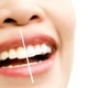 Cosmetic Dentistry in North Little Rock AR
