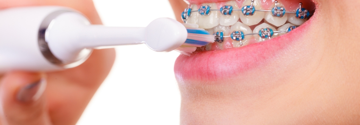 Dental Care in North Little Rock AR