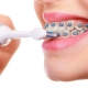 Dental Care in North Little Rock AR
